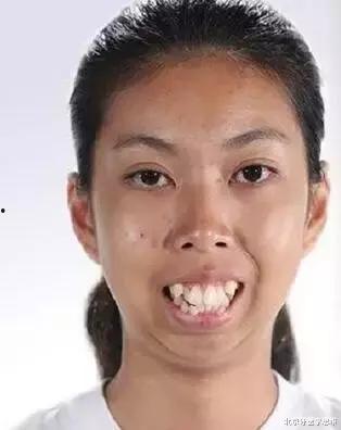 网红丑女龅牙图片大全,真实与美的多元诠释