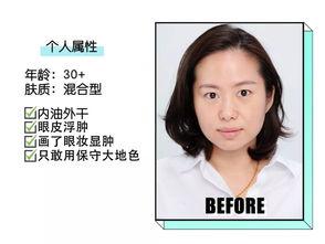 整形头条博主有哪些,揭秘热门整形博主背后的故事与技巧